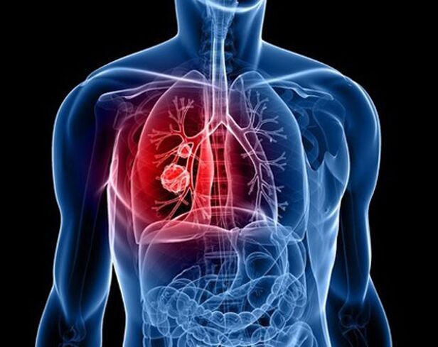 Pasożyty w płucach