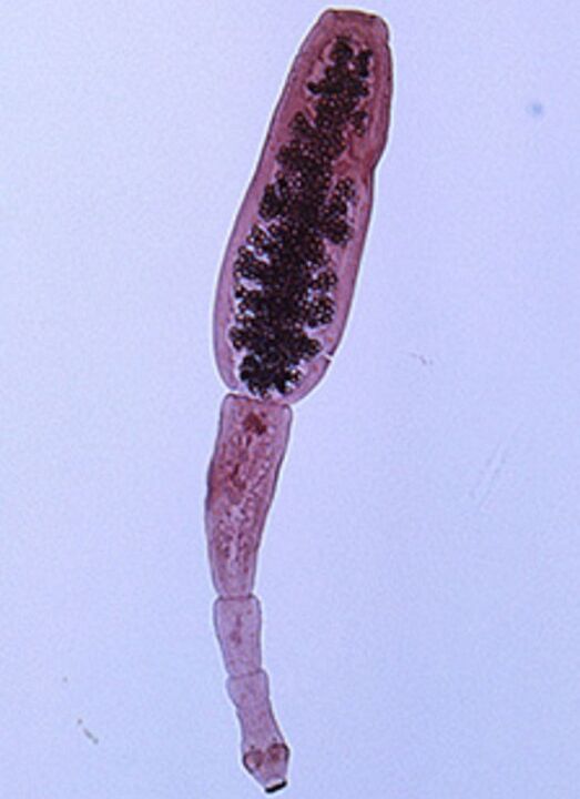 Echinococcus z ludzkiego ciała