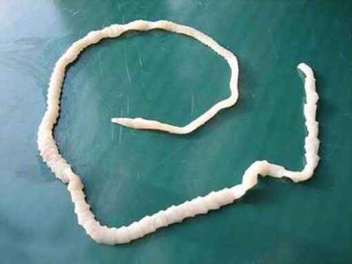 ludzki tasiemiec wieprzowy