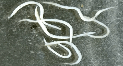 owsiki w organizmie człowieka