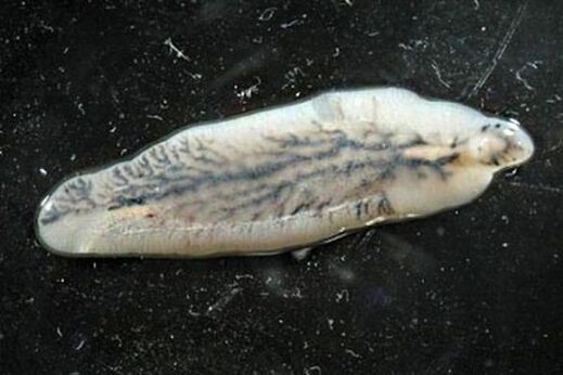 przywra wątrobowa u ludzi