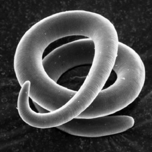 robak pasożytniczy włośnica u ludzi