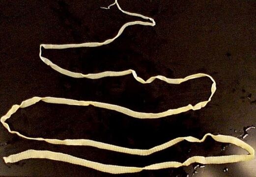 szeroki tasiemiec z ludzkiego ciała