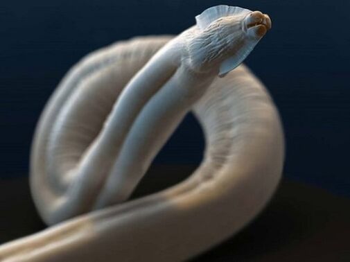 toxocara z organizmu człowieka