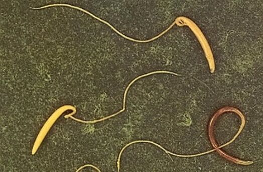 włosogłówka z ludzkiego ciała